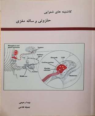 کاشتینه های شنوایی حلزونی و ساقه مغزی